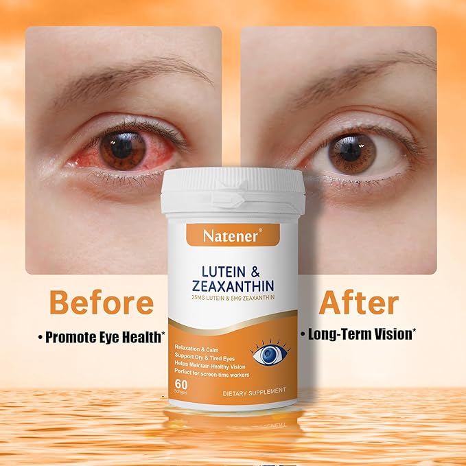 14 in 1 Eye Vitamins, 25mg Lutein, 5mg Zeaxanthin, 24mg Astaxanthin, 800mg Omega-3 & 100mg L-Theanine, Supports Eye Health, Moisture and Comfort*