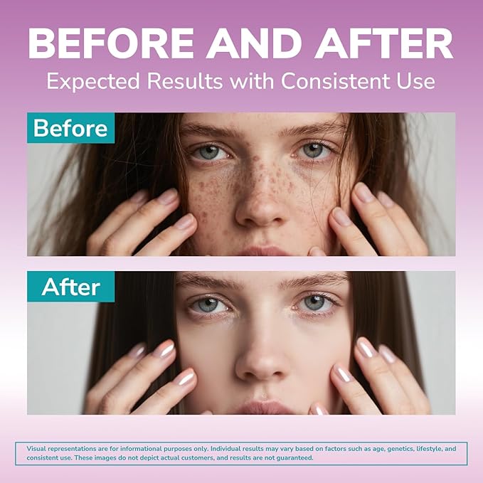 Biotin 10000mcg, Vitamin B7, Hydrolyzed Keratin, Hyaluronic Acid, Collagen, Amino Acids, MSM, Vitamins A, C, D3, B Complex, Hair, Nail, Skin, for Women & Men, 60 Caps
