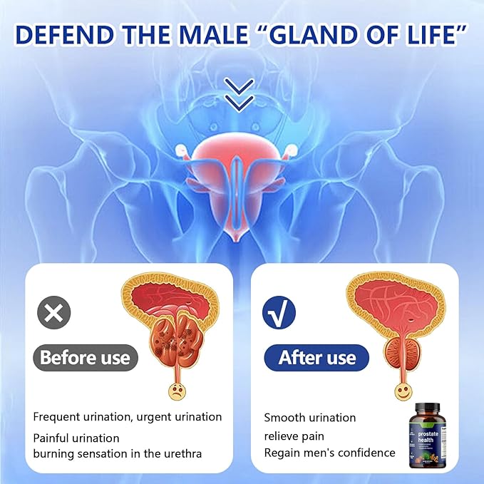 Extra Strength Saw Palmetto Extract - Advanced Herbal Complex for Hair Health and Urinary Support with Plant Sterols & Flavonoids - Potent Herbal Supplement with 500mg per Serving