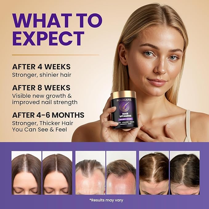 Biotin Hair Growth Supplement with Collagen, Keratin, and Probiotics – Hair Growth Support, Skin & Nails Supplement for Men and Women – Supports Thicker, Stronger Hair – Made in USA (2 Pack)