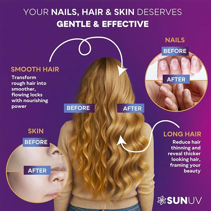 SUNUV Biotin 10,000mcg | Collagen | Keratin | Hyaluronic Acid - 80,000mcg Hair Growth Vitamins for Hair Skin & Nails Support - Women & Men - Vitamins B1,B2,B3,B5,B6,B9,B12 -Made in USA-90 Capsules