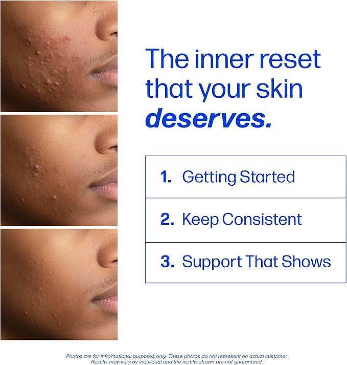 Clear Skin Supplement with Zinc, DIM & Probiotics | Doctor-Formulated | 3-in-1 Hormone, Gut & Complexion Support | Triple Action Hyaluronic Acid & Vitamins for Skin Balance & Glow Support | 120 Ct