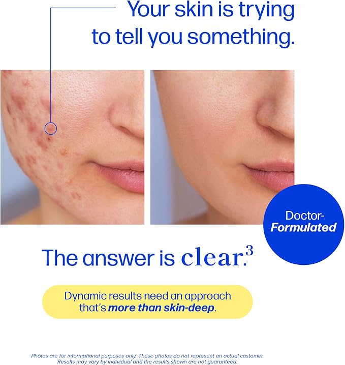 Clear Skin Supplement with Zinc, DIM & Probiotics | Doctor-Formulated | 3-in-1 Hormone, Gut & Complexion Support | Triple Action Hyaluronic Acid & Vitamins for Skin Balance & Glow Support | 120 Ct