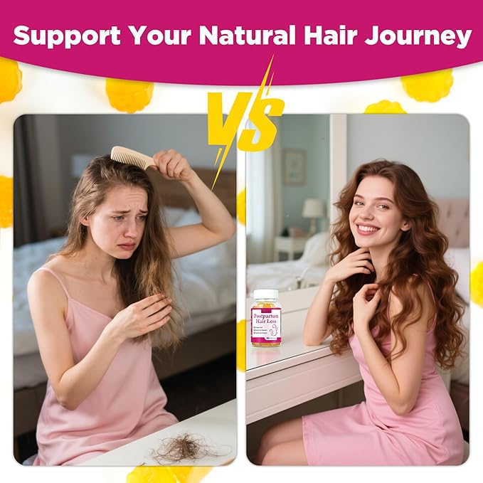 Aromlife Postpartum Hair Loss Gummies for Women Stronger Hair, Postpartum Hair Gummies with Biotin, Folate, Zine, Vitamin E, B6 & B12, 60 Count Vegan Breastfeeding-Friendly Postnatal Vitamins Gummy