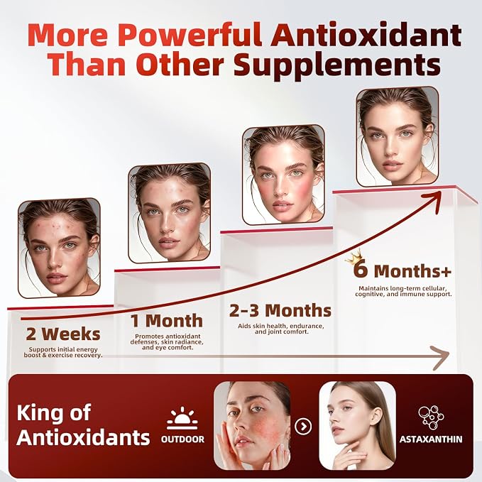 Astaxanthin 24mg, 180 Softgels | 6 Month Supply of Premium Antioxidant | Triple Strength for Eye, Immune, Skin & Circulation Support | Easy to Swallow, Non-GMO, Soy Free