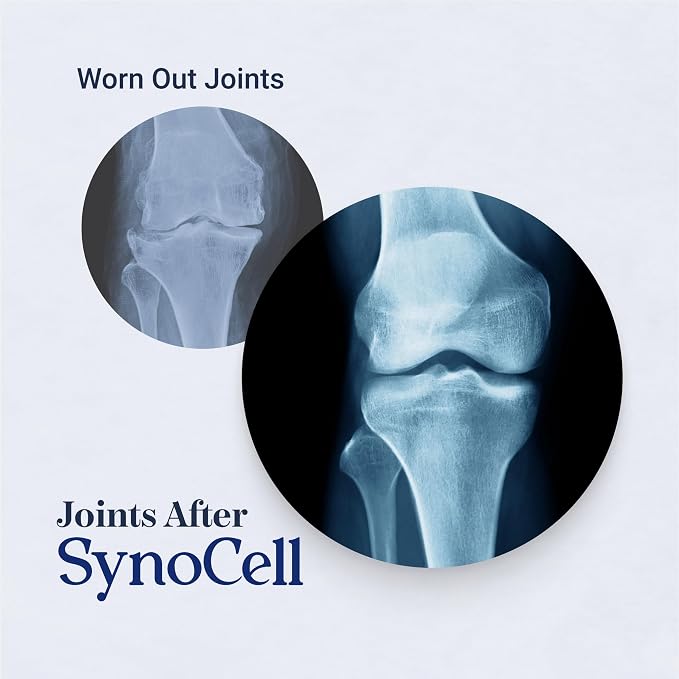 Synocell Glucosamine Chondroitin Complex 2 Pack Back, Neck, and Joint Support Supplement with Boswellia, Quercetin, & MSM - Renew Your Joints from the Inside Out - Move with Freedom and Ease
