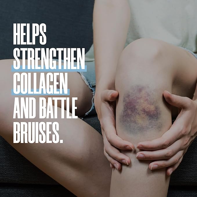 ZAX'S Bruise Vitamin Pharmacist Developed Bruising Supplements Potent Bruising Swelling Reducer, Zinc, Vitamin K, D3, Ascorbic Acid, Citrus Bioflavonoids, 60 Caps, Combine Arnica Bruise Cream