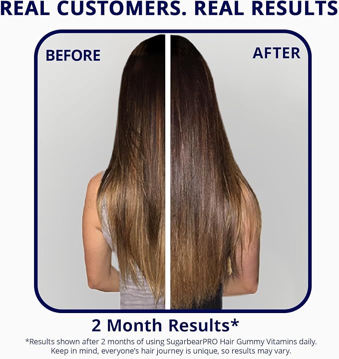 Sugarbear Hair Vitamin Gummy 2 Month Supply Extra Strength Biotin 6000mcg, Growth for Men & Women, Vegan Vitamin B12, MSM, Inositol, Omega 3, Elderberry, Certified Kosher, Halal, Cruelty-Free