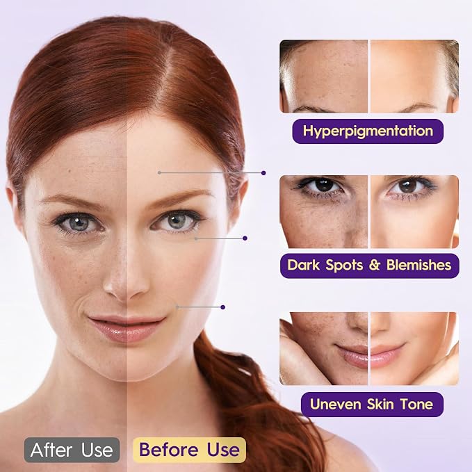 Glutathione Supplement – Skin Brightening Formula with Vitamin C, Niacinamide, Licorice Extract, Collagen & Hyaluronic Acid – for Skin Brightness, Radiance & Hydration – 180 Tablets
