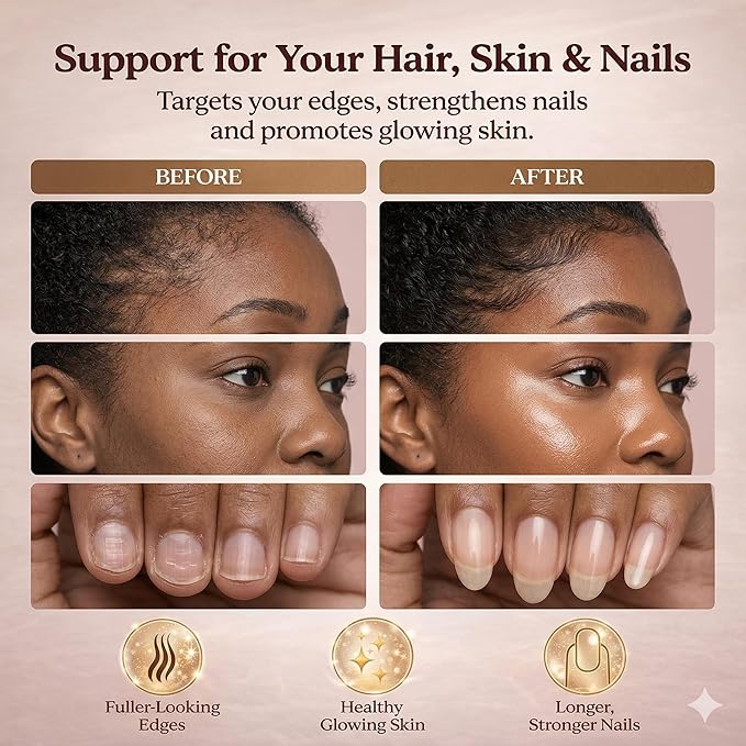 Hair Growth Gummies for Black Women, with Biotin-Silica Complex (5000mg Biotin) & Vitamin D (30mcg), Supports Healthy Hair Growth & Strength, Skin & Nail Care, Non-GMO, 60 Gummies