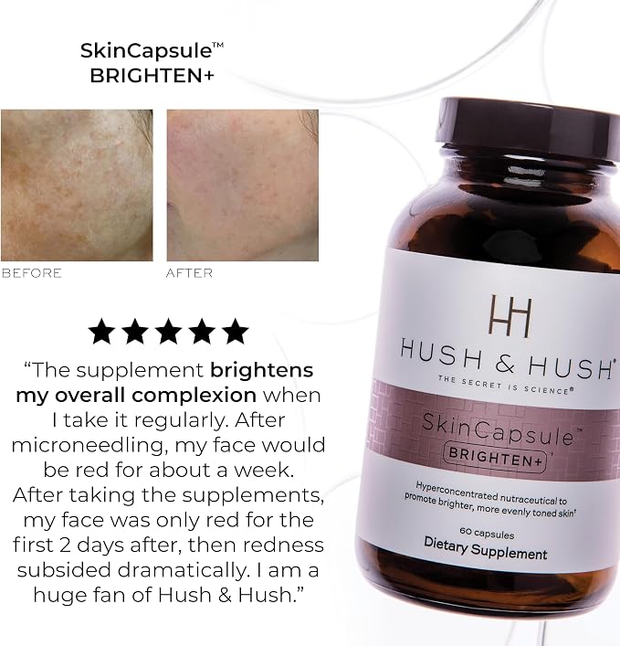 Hush & Hush Vitamin C Supplement for Skin Brightening – Clinically Proven, Antioxidant-Rich Formula to Reduce Dark Spots, Discoloration & Blue Light Damage – Vegan, Non-GMO, Gluten-Free – 60 Capsules