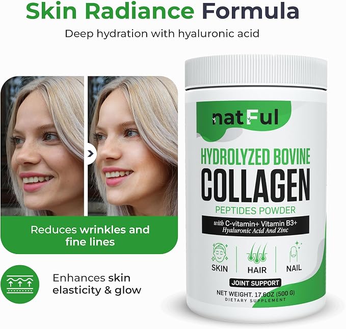 Collagen Peptides Powder – Hydrolyzed Bovine Collagen with Vitamin C, Hyaluronic Acid, Zinc & B3 – Type 1 & 3 Unflavored Protein Powder for Women & Men Hair, Skin, Nails, Joints 45 Servings