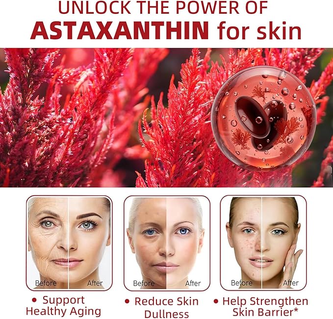 Astaxanthin 24mg, Premium Astaxanthin Antioxidant Supplements with MCT Oil, Ashwagandha, Supports Eye, Skin, Immune, Internal Circulation, Fresh Microalgae Source, Triple Strength - 300 Softgels