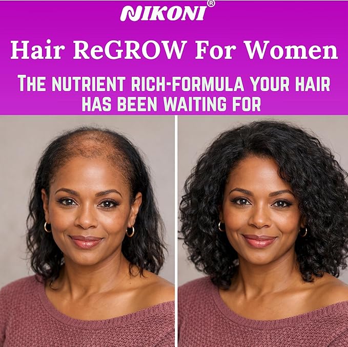 Nikoni Hair ReGROW Women’s Liposomal Formula – Biotin, Keratin, Saw Palmetto & Botanical Essentials-60 Vegan Softgels