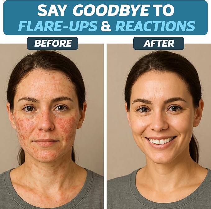 Nutri-Spec Immune Power - Immuno-Synbiotics Probiotics & Prebiotic for Women & Men - with Lactobacillus gasseri, rhamnosus, paracasei - Great for Immune-Related Inflammatory Conditions - 120 Caps