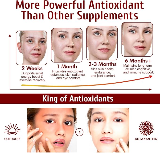 2 Pack Astaxanthin 12mg,Premium Astaxanthin Antioxidant Supplements with Antioxidant Activity, Supports Eye, Immune, Joint, Skin Health, Internal Circulation