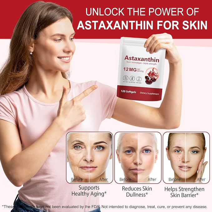 Astaxanthin Supplements, Supports Eye, Joint, Internal Circulation, Skin Health, Astaxanthina Antioxidant Supplements (1Bag120P)